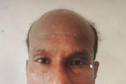 ಅಪ್ರಾಪ್ತ ಬಾಲಕಿ ಮೇಲೆ ಲೈಂಗಿಕ ದೌರ್ಜನ್ಯವೆಸಗಿ ಉಸಿರುಗಟ್ಟಿಸಿ ಕೊಲೆಗೈದ ಆರೋಪಿಗೆ ಶಿಕ್ಷೆ ಪ್ರಕಟ